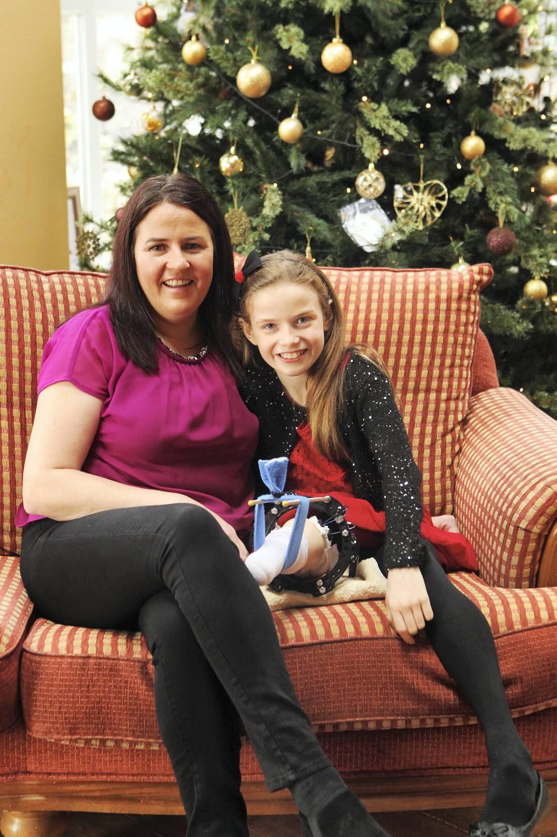 A special girl with a special leg A special girl with a special leg