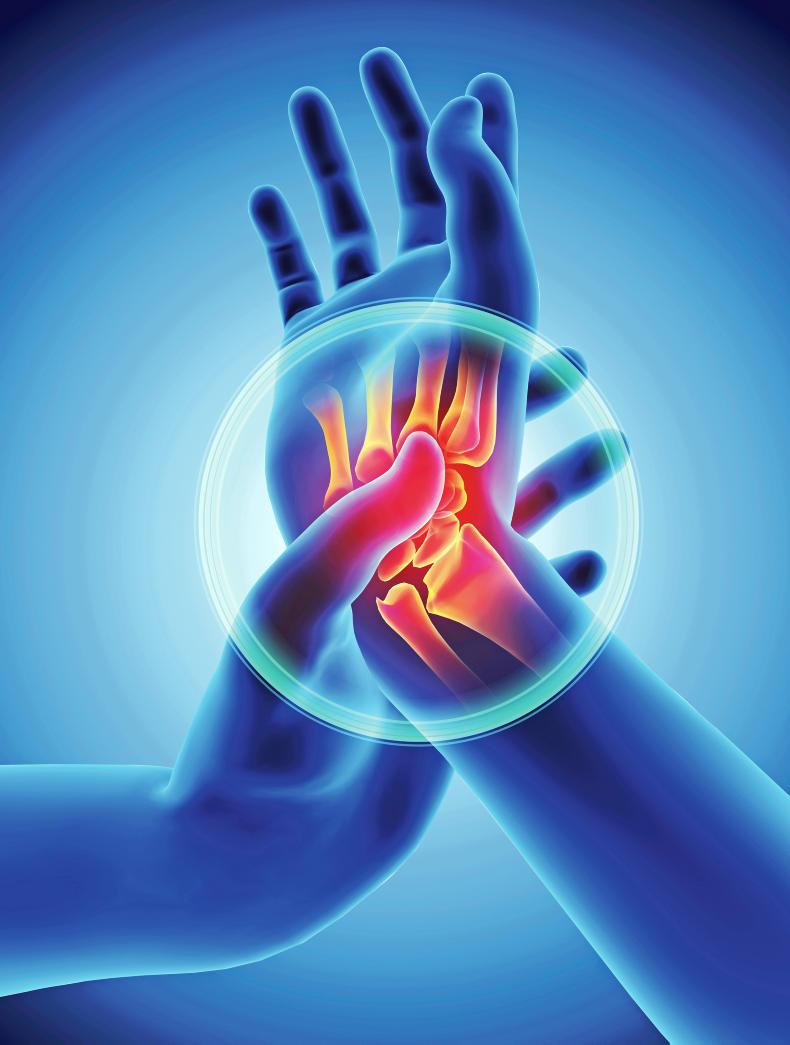 Carpal tunnel syndrome - what can be done to help? Carpal tunnel syndrome - what can be done to help?