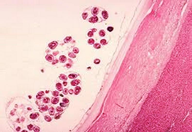 Cryptosporidiosis: a form of scour which prominently affects young calves Cryptosporidiosis: a form of scour which prominently affects young calves