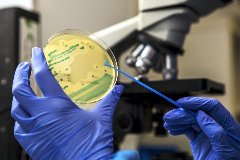 Cost saving causes disease surveillance revamp Cost saving causes disease surveillance revamp